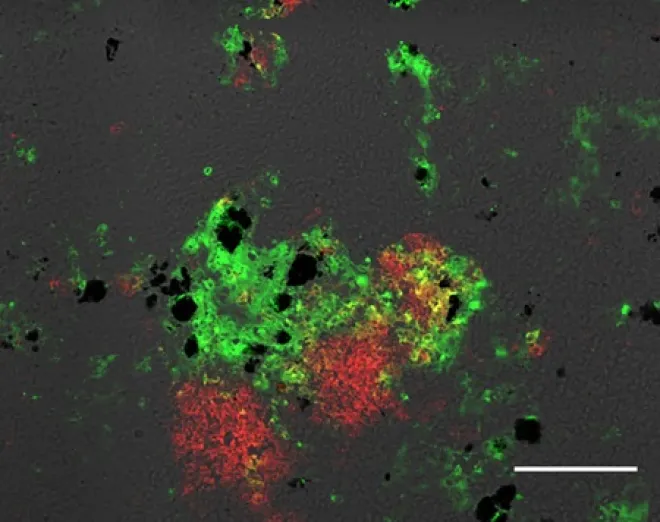 A rainbow trout M-LA. Immunofluorescence microscopy shows a representative M-LA induced in the spleen from Ichthyophthirius multifiliis-infected trout. Cryosections were stained for IgM (green) and CD4 (red). Scale bar, 100 μm. Groups of dark cells are MMCs.